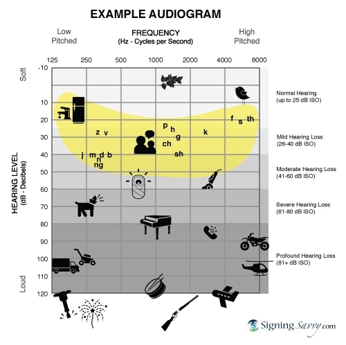 Example Audiogram